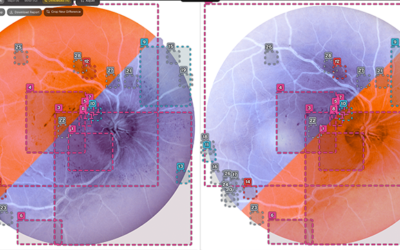 The New Lens of Medicine: How AI is Transforming Medical Imaging