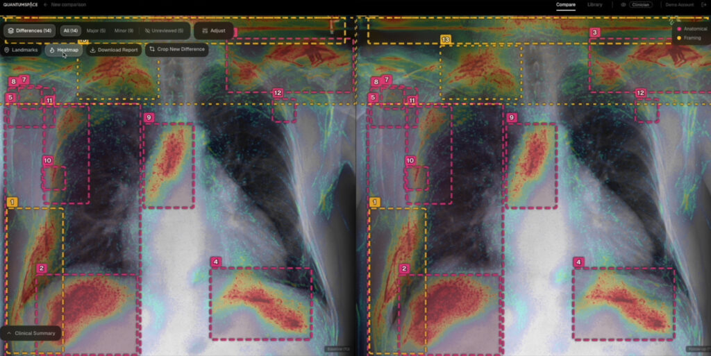 QuantumSpace_Activity_Biomedics_3