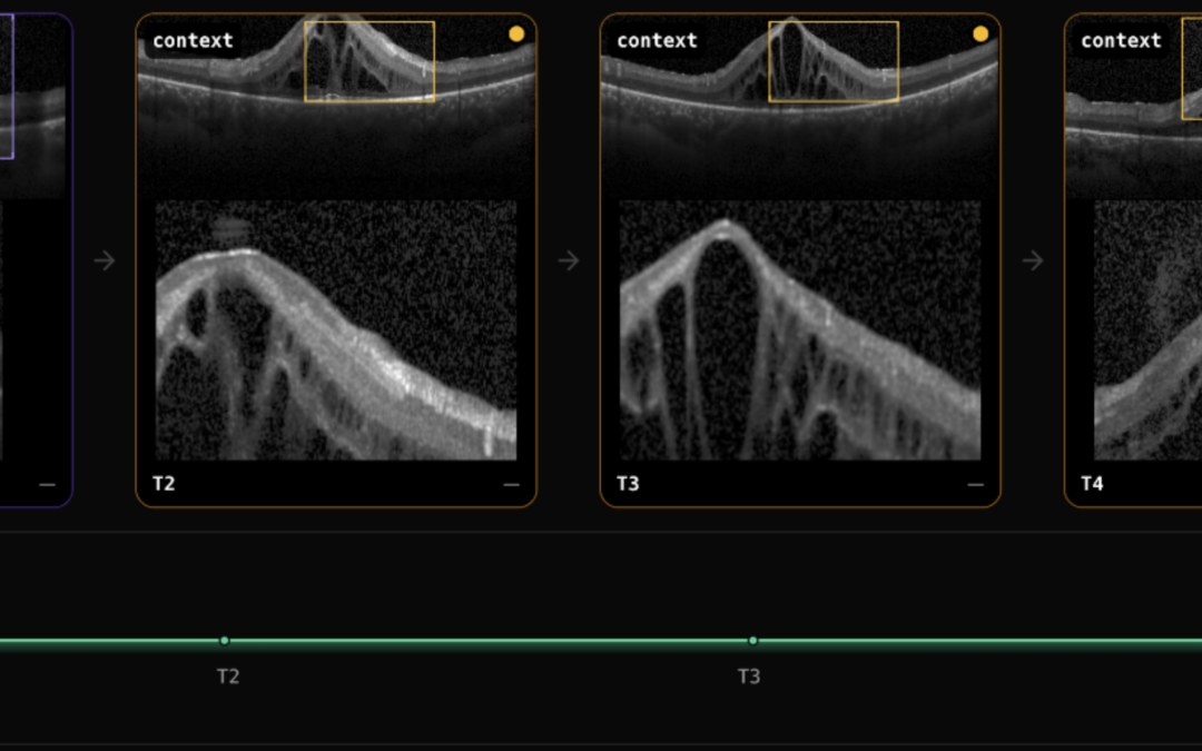 Fatigue and Performance Diagnosis: The QLens Solution