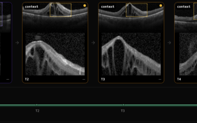 Fatigue and Performance Diagnosis: The QLens Solution
