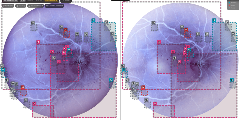 Eye_comparison_blue
