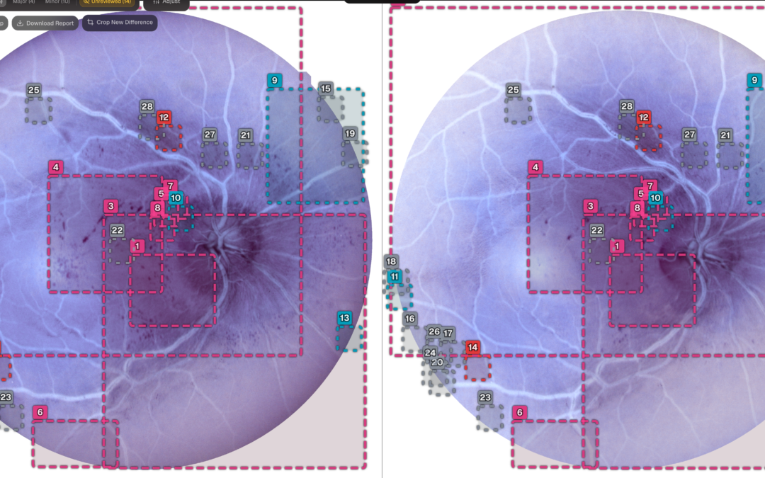 QuantumSpace AI Launches QLens for U.S. Clinicians